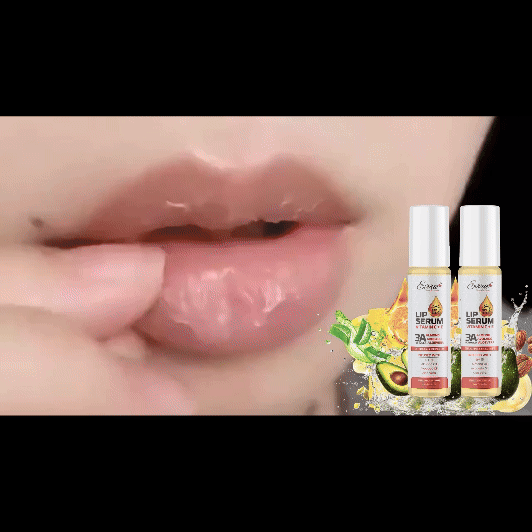 Lip Serum - EVVUE Vitamin C + E Lip Oil (10ml)