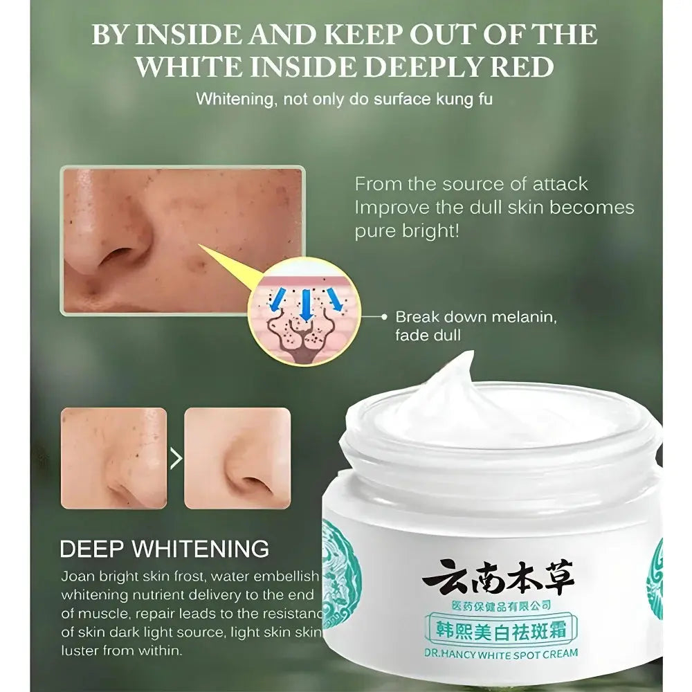 Japanese Melasma Cream, Face Cream