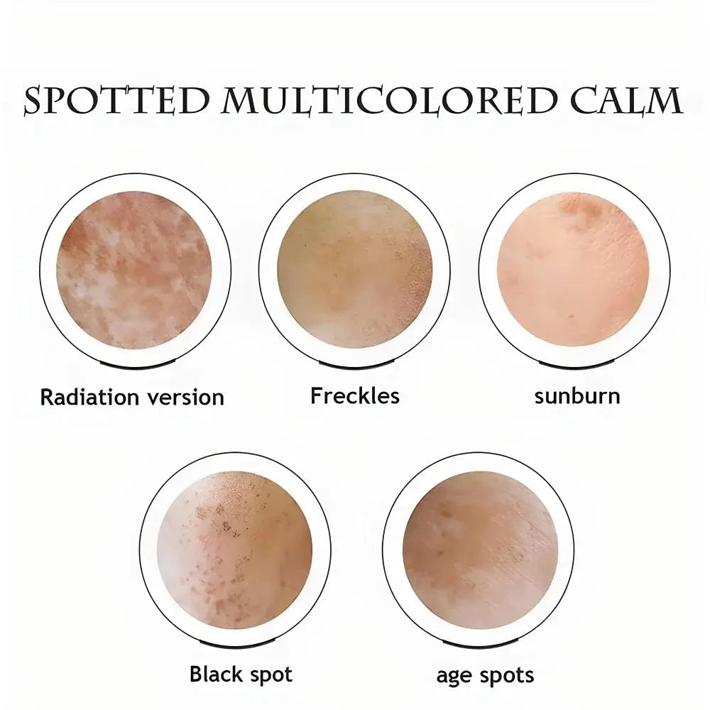Japanese Melasma Cream, Face Cream