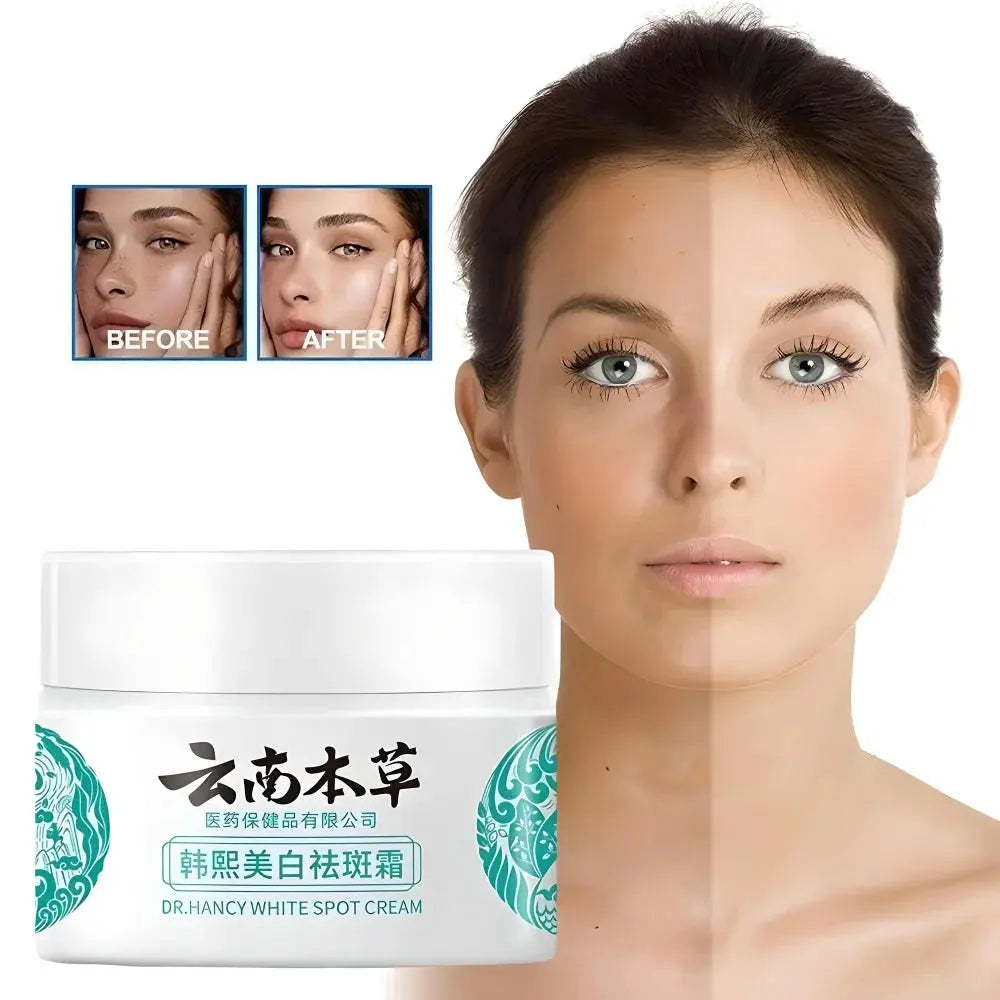 Japanese Melasma Cream, Face Cream