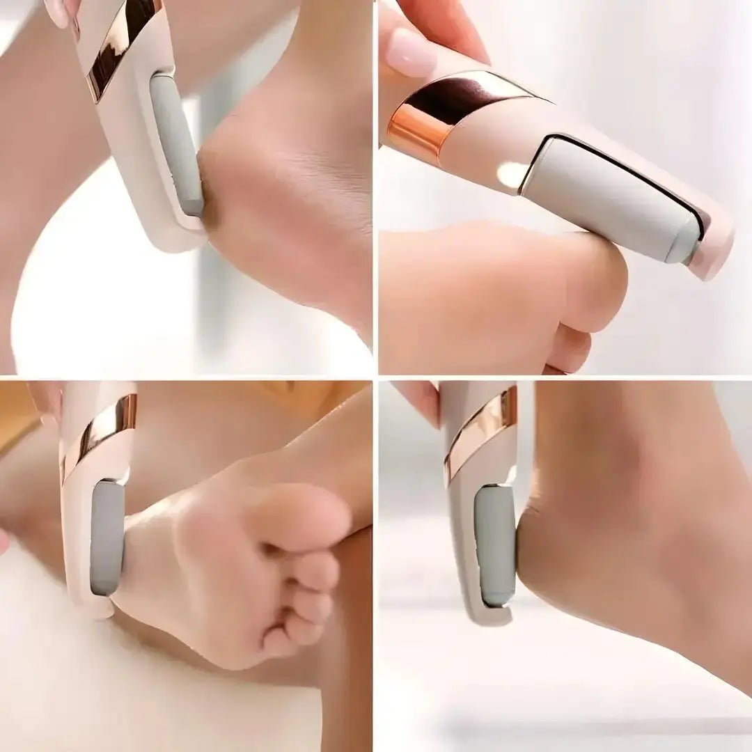 Dead Skin Remover Electronic Cordless Pedicure Callus Polishing Tool