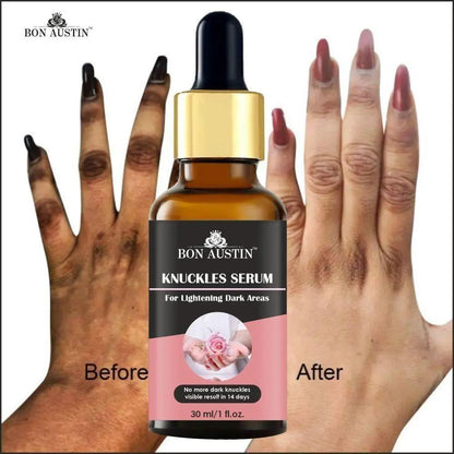 Skin Whitening Serum