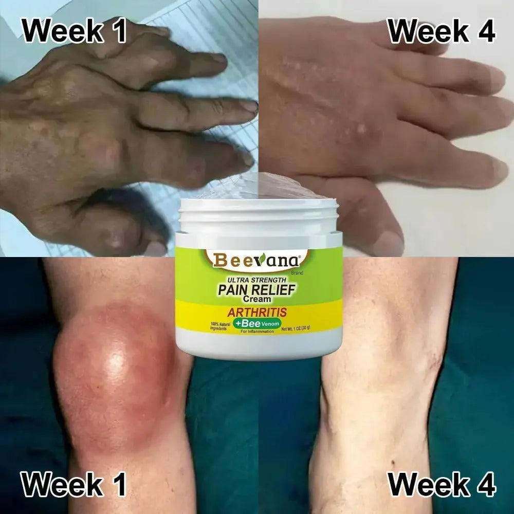 Joint Pain Relief Cream