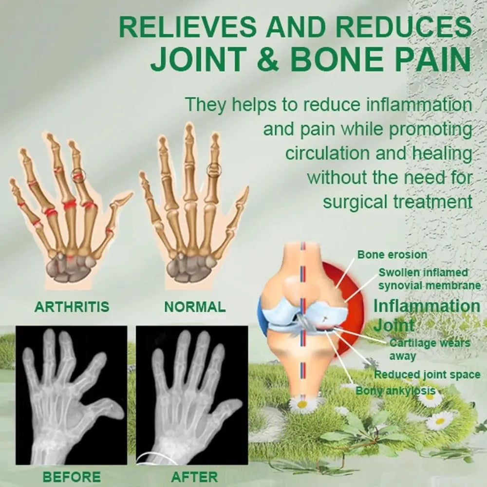 Joint Pain Relief Cream