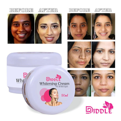 Skin Whitening Cream