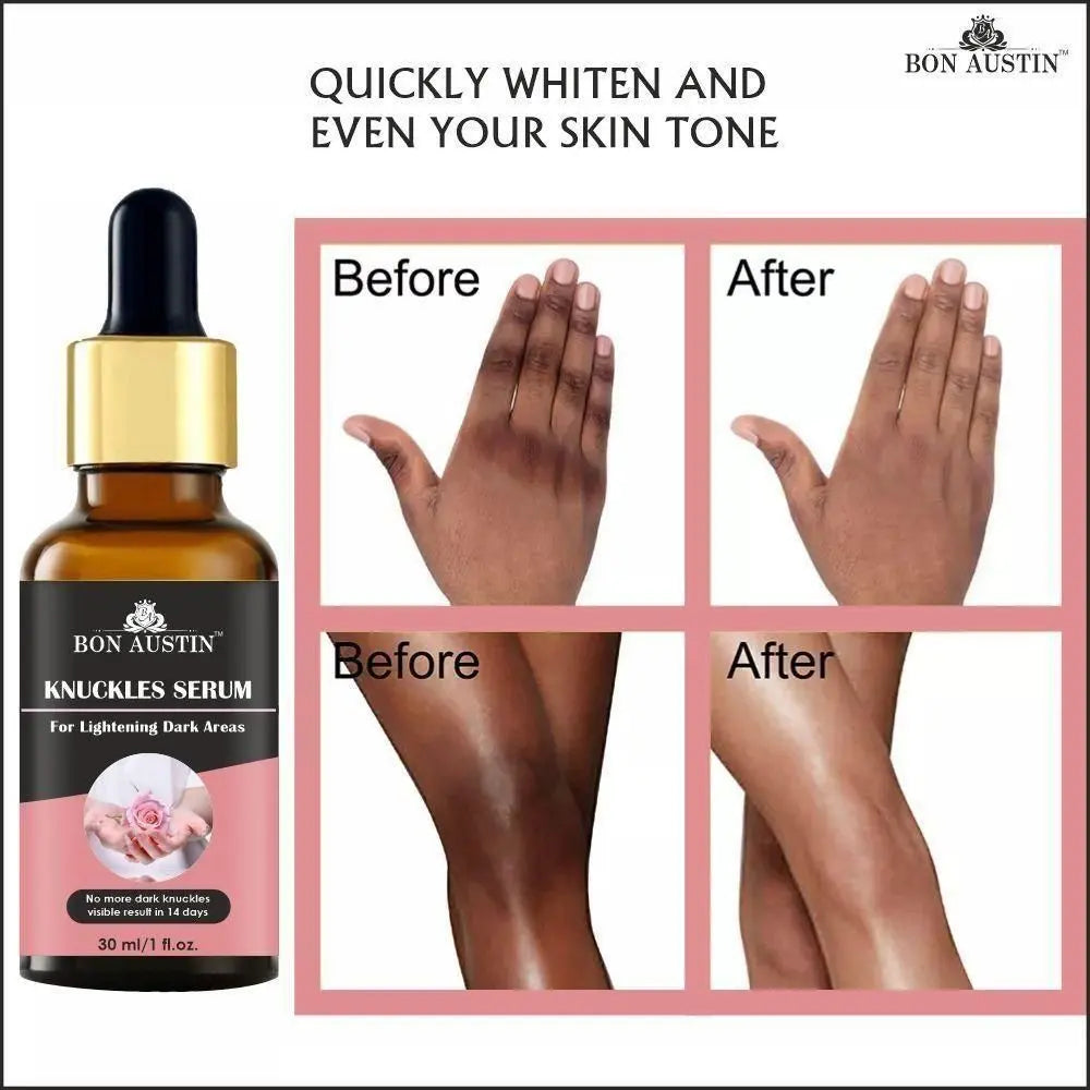 Skin Whitening Serum