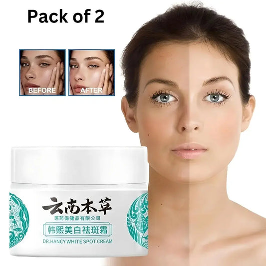 Japanese Melasma Cream, Face Cream