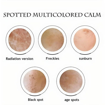 Japanese Melasma Cream, Face Cream
