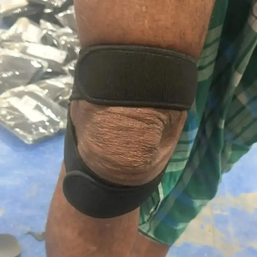 Knee Strap for Pain