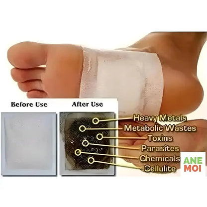 Detox Foot Patches (Set of 10)