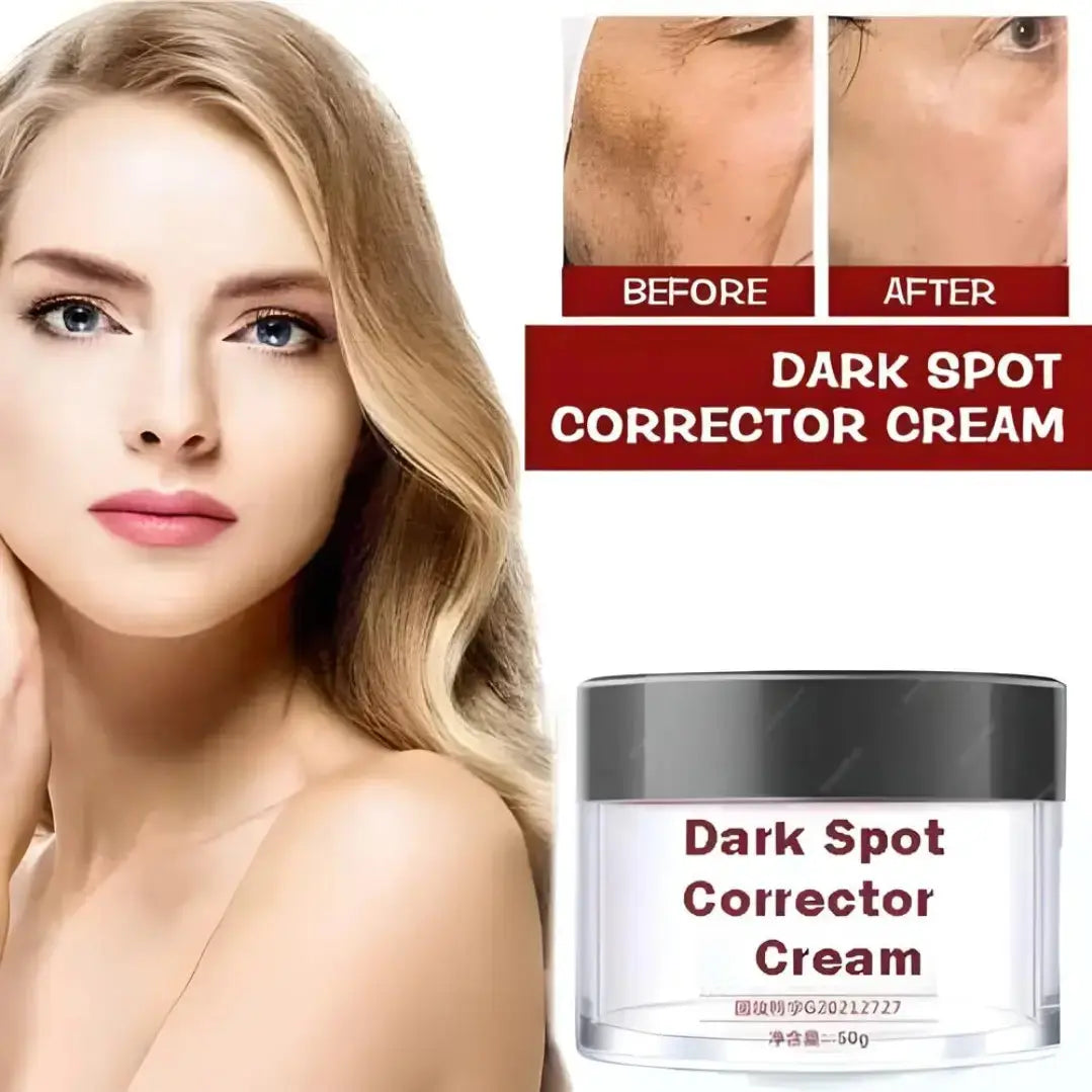 Dark Spot Removal Cream, Dark Spot Corrector Cream