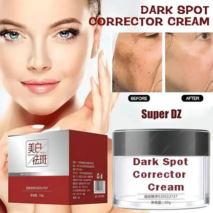 Dark Spot Removal Cream, Dark Spot Corrector Cream