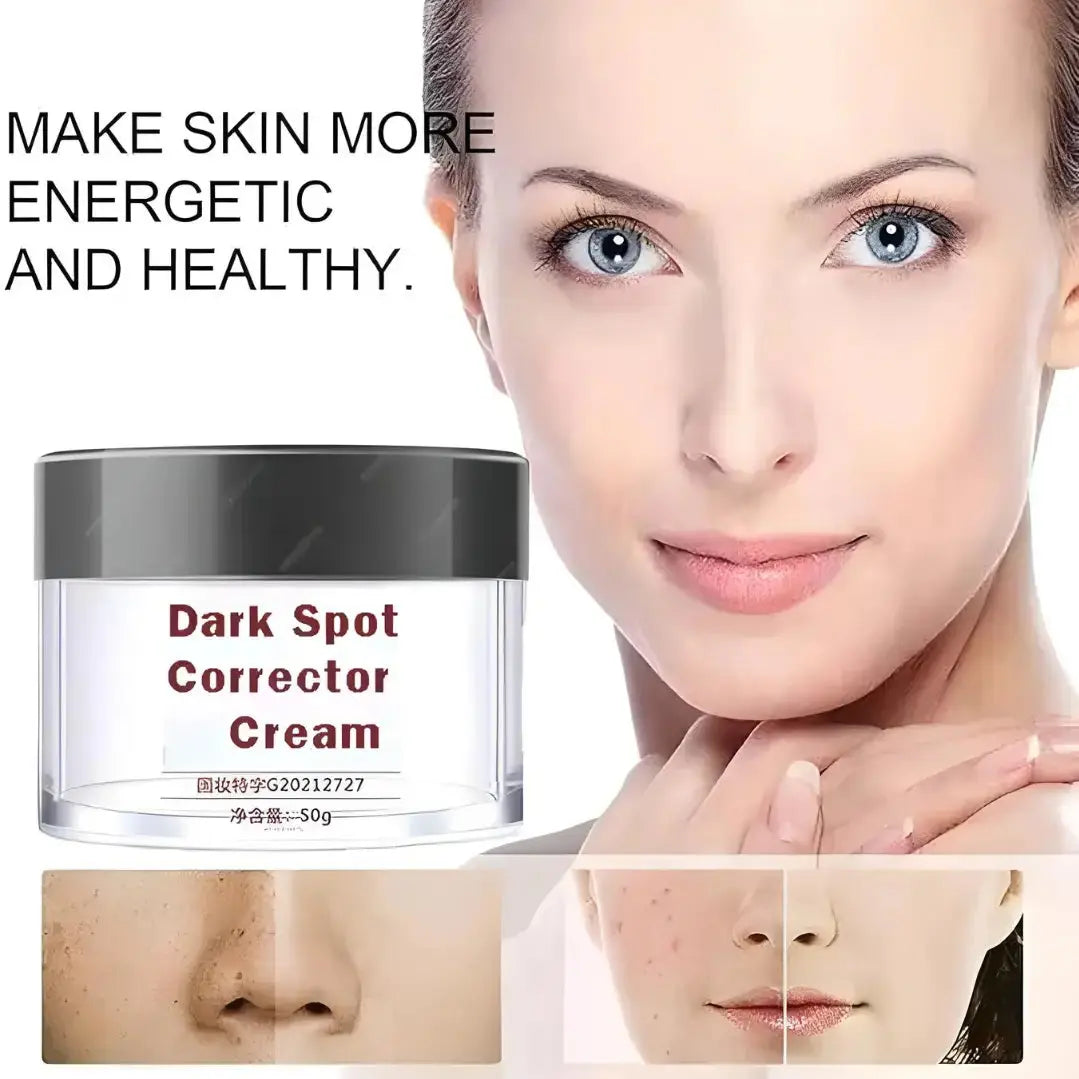 Dark Spot Removal Cream, Dark Spot Corrector Cream