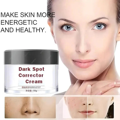 Dark Spot Removal Cream, Dark Spot Corrector Cream